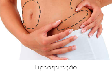 LIPOASPIRAÇÃO