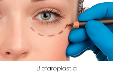 blefaroplastia